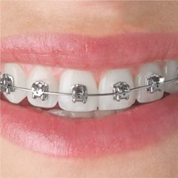 Orthodontic